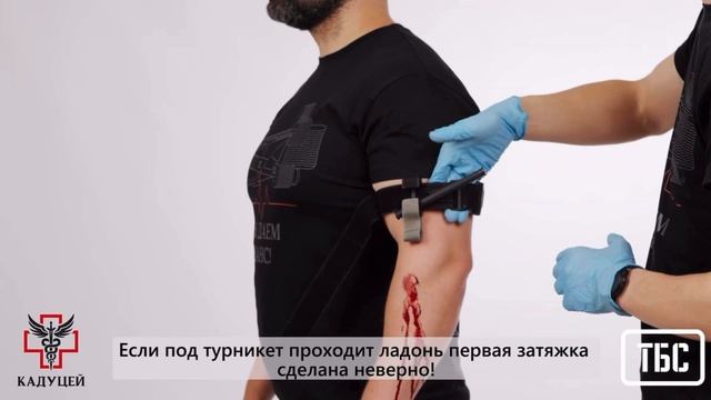 Наложение турникета на верхние конечности при оказании взаимопомощи