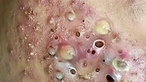 Уход за очищением кожи с расслабляющим массажем лица #4374845
