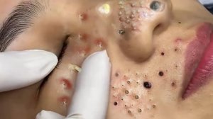 Успокаивающий уход за лицом для снятия стресса в спа-салоне. Обретите внутренний покой #553128