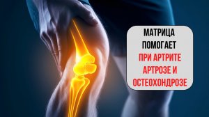 Матрица для суставов – восстановление при артрозе, остеохондрозе и артрите!