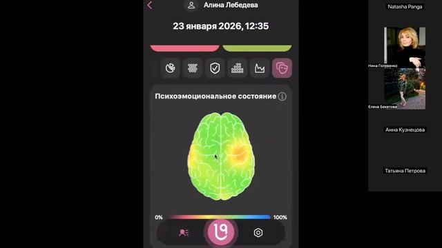 Разбор показателей + ответы на вопросы DoTERRA смотреть онлайн