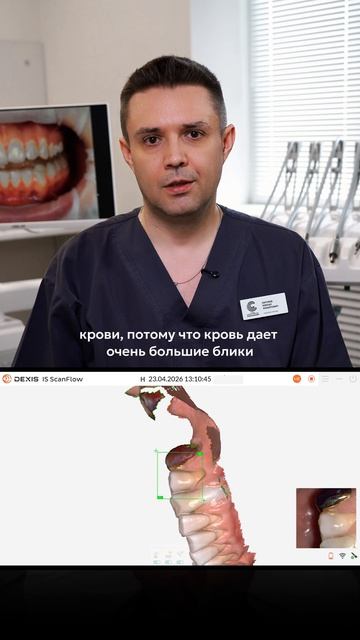 Кейс, знакомый почти каждому стоматологу-ортопеду 🤔