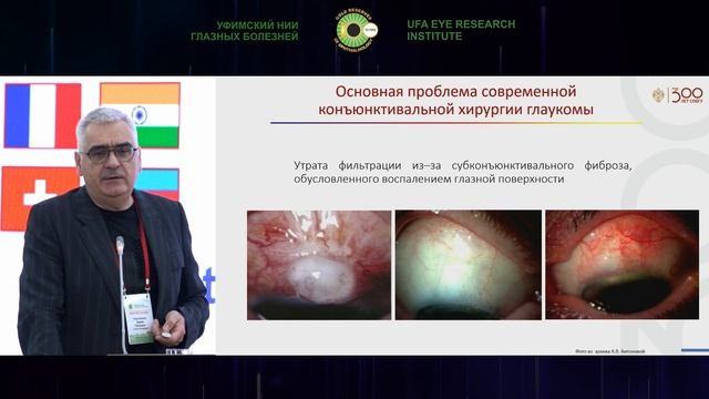 Сессия Российского глаукомного общества