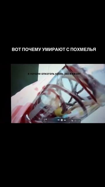 Вместо опохмелина - кардиомагнил...