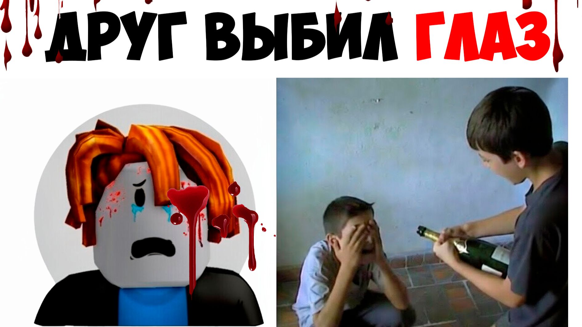 Этот Роблокс Игрок Стал ИНВАЛИДОМ
