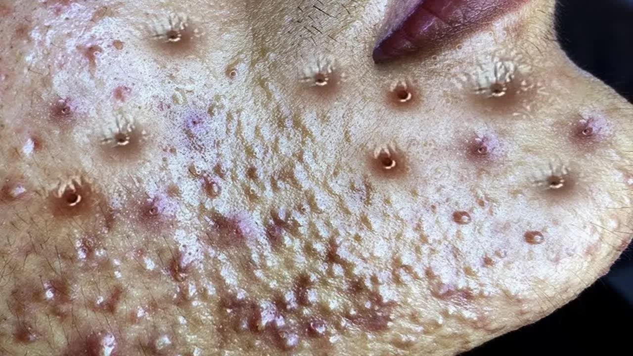 Успокаивающий уход за лицом для снятия стресса в спа-салоне: обретите внутренний покой #553162 смотреть онлайн