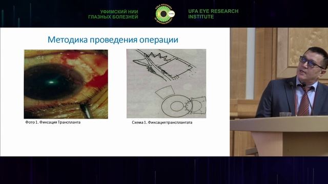 Сессия офтальмологов Кыргызстана