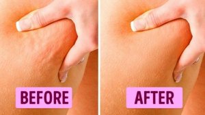 10 ФАКТОВ, ДОКАЗЫВАЮЩИХ, ЧТО КРАСОТА ТРЕБУЕТ ЖЕРТВ