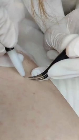 Подготовка кабинета к процедуре электроэпиляции и сама проудра электроэпиляции в сети WAX BAR