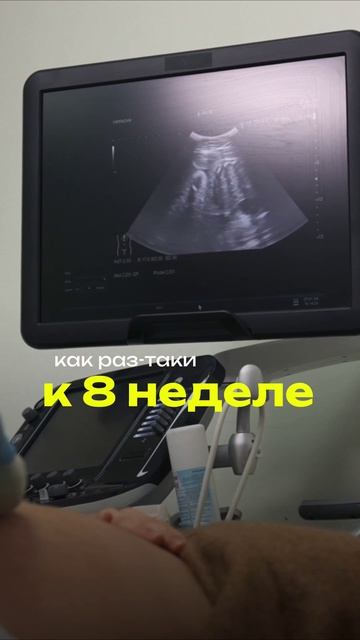 Замершая беременность - что смотреть?