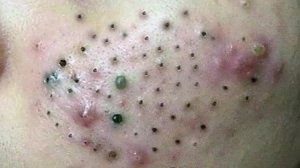 Нежное очищение лица для спокойного и счастливого времени #6137745