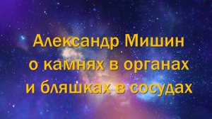 Катушка Мишина Александр Мишин о камнях в органах и бляшках в сосудах