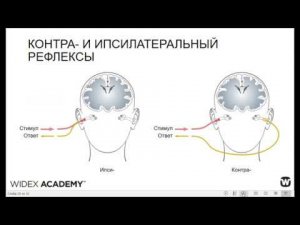 Нарушения слуха. Методы исследования.