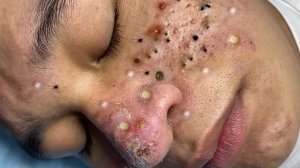 Успокаивающий уход за лицом для снятия стресса в спа-салоне класса люкс. Обретите внутренний поко...