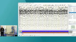 EEG on the ICU- essential insights for non-neurophysiologists ISICEM 45