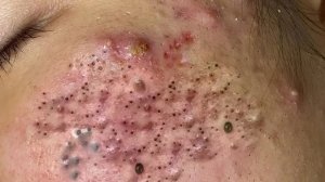 Успокаивающий уход за лицом для снятия стресса в спа-салоне: обретение внутреннего покоя #2661177