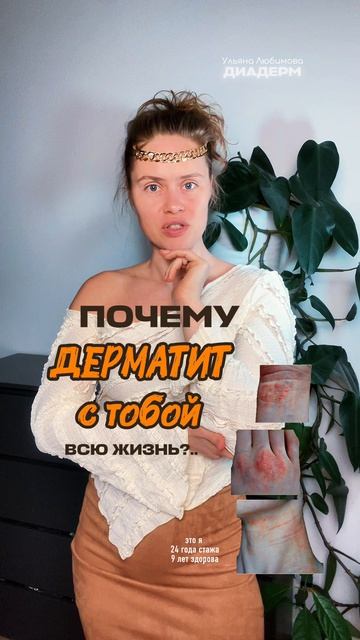 ПОЧЕМУ ДЕРМАТИТ НЕ УХОДИТ ВСЮ ЖИЗНЬ? У нас он тоже был 20-30-40 лет, но мы восстановили биохимию!