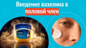 🤨 Введение вазелина в половой член. Клинический случай № 1737