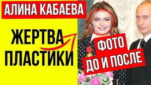 Рассталась с грузином накануне свадьбы и сделала неудачную пластику: Как сейчас живет Алина Кабаева