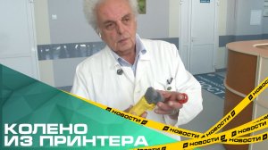 Пациентке из Челябинска установили изготовленный с помощью 3D-печати эндопротез