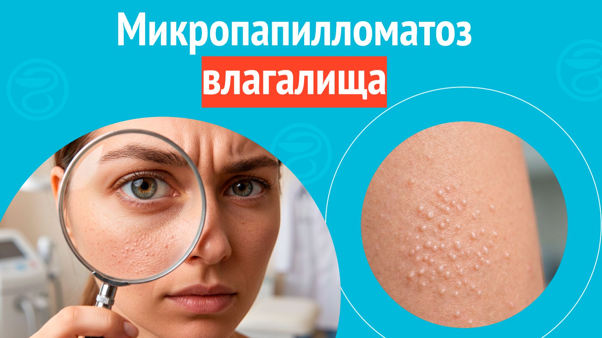 👉 Микропапилломатоз влагалища. Клинический случай № 1738 смотреть онлайн