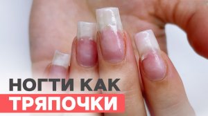 Ужасное состояние ногтей после самостоятельного снятия | Восстановление верхними формами