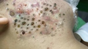 Успокаивающий уход за лицом для снятия стресса в спа-салоне: обретите внутренний покой #553157
