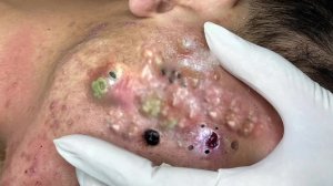 Успокаивающий уход за лицом для снятия стресса в спа-салоне. Обретите внутренний покой #553156