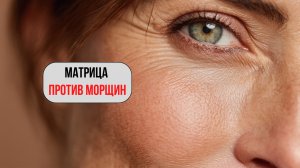 ✨ ЗВУКОВАЯ МАТРИЦА ОТ МОРЩИН – ОМОЛОЖЕНИЕ КОЖИ! ✨💖
