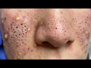 Чистка пор с расслабляющим массажем лица #467826