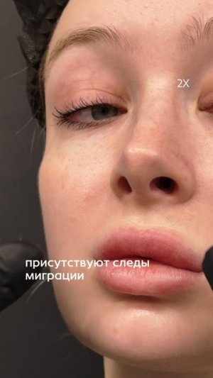 исправляем губы