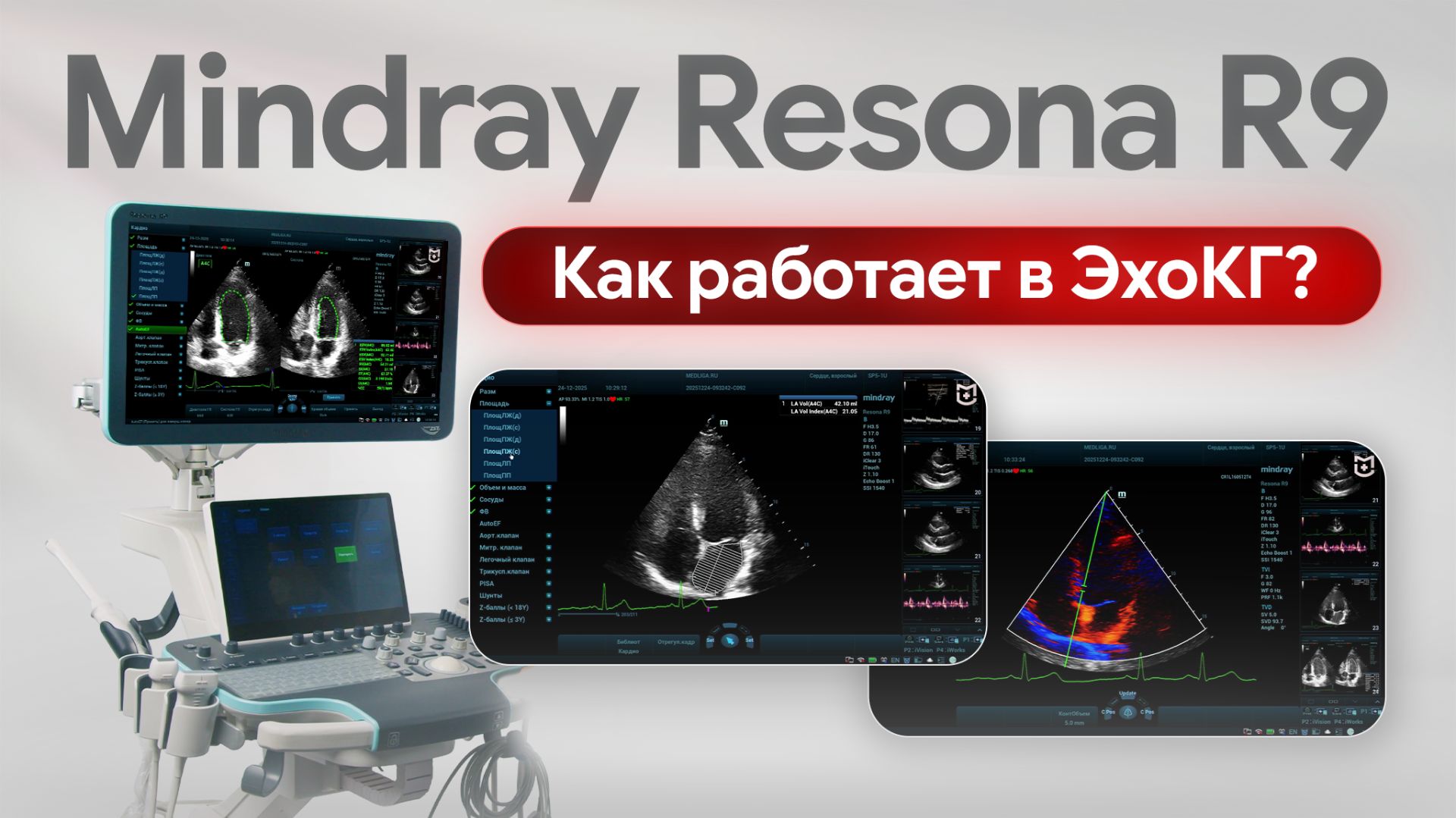 Mindray Resona R9 в эхокардиографии: мастер-класс по исследованию сердца