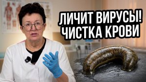 Пиявки лечат не только вены, но и вирусы. Как секрет слюны пиявки очищает кровь?