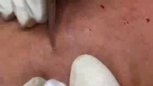 Уход за чистыми порами с расслабляющим массажем лица #467826