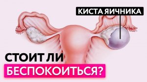 Чем опасна киста яичника? Симптомы и лечение восточной медициной без операции