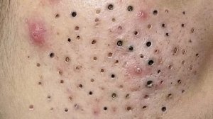 Нежное очищение лица для спокойного и счастливого идеального времени