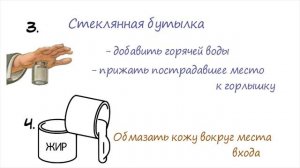 ГЛУБОКАЯ ЗАНОЗА быстро ВЫЙДЕТ БЕЗ ТРУДА! Как достать занозу