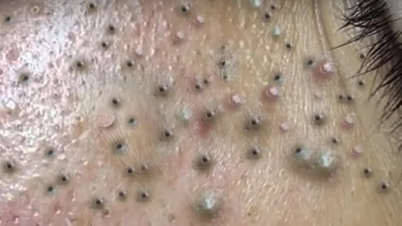 Успокаивающий уход за лицом для снятия стресса в спа-салоне класса люкс. Обретите внутренний поко... смотреть онлайн