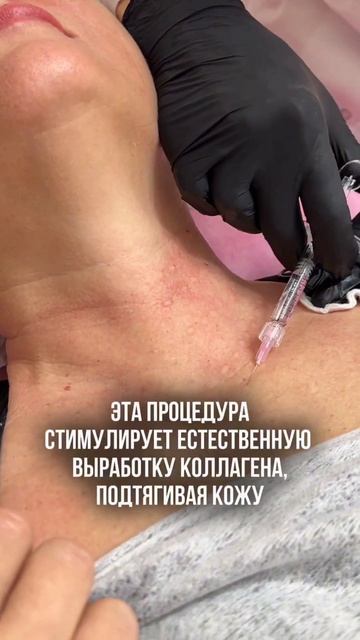 БИОРЕВИТАЛИЗАЦИЯ ШЕИ — В ЧЕМ ЕЁ ПРЕИМУЩЕСТВА?