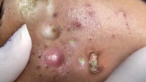 Успокаивающий уход за лицом для снятия стресса в спа-салоне. Обретите внутренний покой #55375