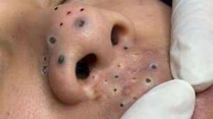 Достигните внутреннего покоя с помощью этих методов очищения лица #7234643