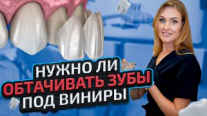 Виниры: больно ли ставить и нужно ли обтачивать зубы? Вся правда от ортопеда.