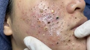Достигните внутреннего покоя с помощью этих методов очищения лица