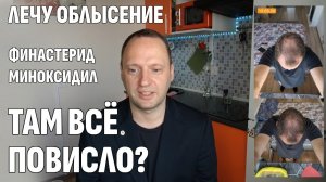 Влог: Финастерид + Миноксидил / Мои побочки, импотенция и результаты за 1 месяц / Лечение АГА