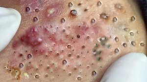 Успокаивающий уход за лицом для снятия стресса в спа-салоне класса люкс: обретение внутреннего покоя