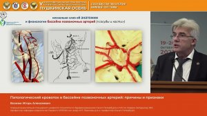 Вознюк Игорь Алексеевич Патологический кровоток в бассейне позвоночных артерий причины и признаки