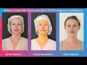 Аппарат Infusion Mix. Мастер класс для омоложения сухой кожи.