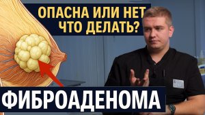 Фиброаденома молочной железы: опасно ли это и когда нужна операция?
