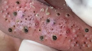 Успокаивающий уход за лицом для снятия стресса в спа-салоне класса люкс: обретите внутренний поко...