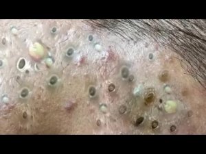 الآن وقت الاسترخاء #70040